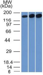 Topoisomerase II alpha (Proliferation and Drug-Resistance Marker) Antibody in Western Blot (WB)