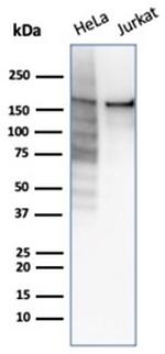 Topoisomerase II alpha Antibody in Western Blot (WB)