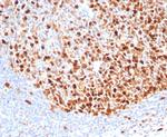 Topoisomerase II alpha (Proliferation and Drug-Resistance Marker) Antibody in Immunohistochemistry (Paraffin) (IHC (P))