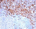 Topoisomerase II alpha (Proliferation and Drug-Resistance Marker) Antibody in Immunohistochemistry (Paraffin) (IHC (P))