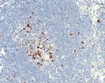 Topoisomerase II alpha (Proliferation and Drug-Resistance Marker) Antibody in Immunohistochemistry (Paraffin) (IHC (P))