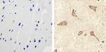 RAB11A Antibody in Immunohistochemistry (Paraffin) (IHC (P))