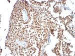 p53 Tumor Suppressor Protein Antibody in Immunohistochemistry (Paraffin) (IHC (P))
