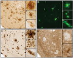 beta Amyloid Antibody in Immunohistochemistry (Frozen) (IHC (F))