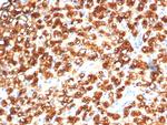 TPH1/Tryptophan Hydroxylase 1 Antibody in Immunohistochemistry (Paraffin) (IHC (P))