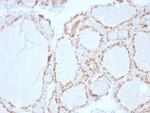 TPO (Thyroid Peroxidase) (Thyroid Marker) Antibody in Immunohistochemistry (Paraffin) (IHC (P))