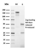 TPO (Thyroid Peroxidase) (Thyroid Marker) Antibody in SDS-PAGE (SDS-PAGE)