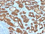 TPO (Thyroid Peroxidase) (Thyroid Marker) Antibody in Immunohistochemistry (Paraffin) (IHC (P))