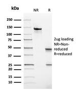 TPO (Thyroid Peroxidase) (Thyroid Marker) Antibody in SDS-PAGE (SDS-PAGE)