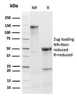 TPO (Thyroid Peroxidase) (Thyroid Marker) Antibody in SDS-PAGE (SDS-PAGE)