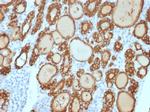 TPO (Thyroid Peroxidase) (Thyroid Marker) Antibody in Immunohistochemistry (Paraffin) (IHC (P))