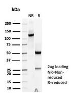 TPO (Thyroid Peroxidase) (Thyroid Marker) Antibody in SDS-PAGE (SDS-PAGE)