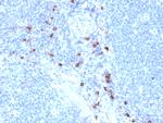 Tryptase (Mast Cell Marker) Antibody in Immunohistochemistry (Paraffin) (IHC (P))