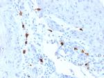 Tryptase (Mast Cell Marker) Antibody in Immunohistochemistry (Paraffin) (IHC (P))