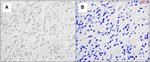 c-Met Antibody in Immunohistochemistry (Paraffin) (IHC (P))