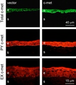 c-Met Antibody in Immunohistochemistry (IHC)