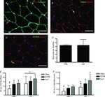 c-Met Antibody in Immunohistochemistry (IHC)