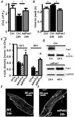 PAK1 Antibody in Western Blot (WB)