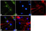 PAK1 Antibody in Immunocytochemistry (ICC/IF)