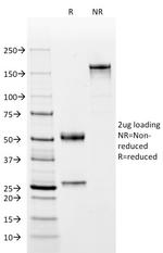 Complement 4d (C4d) Antibody in SDS-PAGE (SDS-PAGE)