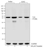 Phospho-Lyn (Tyr507) Antibody in Western Blot (WB)