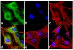 Huntingtin Antibody in Immunocytochemistry (ICC/IF)