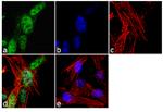 FOXP2 Antibody in Immunocytochemistry (ICC/IF)