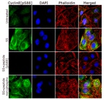 Phospho-Cyclin E (Ser88) Antibody