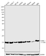 Profilin 1 Antibody in Western Blot (WB)