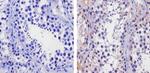 TIP60 Antibody in Immunohistochemistry (Paraffin) (IHC (P))