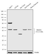 PRMT6 Antibody in Western Blot (WB)