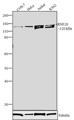 RNF20 Antibody in Western Blot (WB)