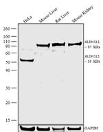 ALDH1L1 Antibody in Western Blot (WB)