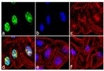 MSX1 Antibody in Immunocytochemistry (ICC/IF)