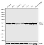 CRHR1 Antibody in Western Blot (WB)