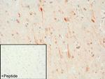 DRD1 Antibody in Immunohistochemistry (IHC)