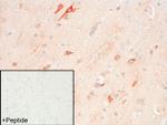 FPR2 Antibody in Immunohistochemistry (IHC)