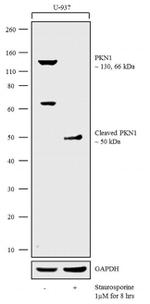 PKN1 Antibody in Western Blot (WB)