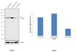 TLK1 Antibody