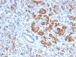 TRPC6/Transient Receptor Potential Cation Channel Subfamily C Member 6 Antibody in Immunohistochemistry (Paraffin) (IHC (P))