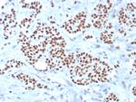 TRPS1 (Transcriptional repressor GATA binding 1) Antibody in Immunohistochemistry (Paraffin) (IHC (P))