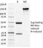 TSH-Receptor, B-Chain (Thyroid Marker) Antibody in SDS-PAGE (SDS-PAGE)