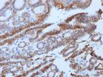 TSH-Receptor, B-Chain (Thyroid Marker) Antibody in Immunohistochemistry (Paraffin) (IHC (P))