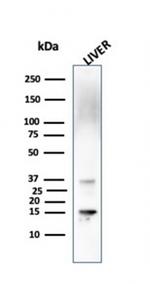 Transthyretin (Prealbumin) Antibody in Western Blot (WB)