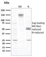 Transthyretin (Prealbumin) Antibody in SDS-PAGE (SDS-PAGE)