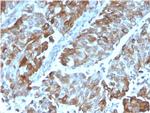 OX40/CD134/ TNFRSF4 (Immuno-Oncology Target) Antibody in Immunohistochemistry (Paraffin) (IHC (P))