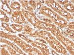 OX40/CD134/ TNFRSF4 (Immuno-Oncology Target) Antibody in Immunohistochemistry (Paraffin) (IHC (P))