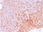 OX40/CD134/ TNFRSF4 (Immuno-Oncology Target) Antibody in Immunohistochemistry (Paraffin) (IHC (P))