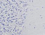 Thymidylate Synthase (5-FU Resistance Marker) Antibody in Immunohistochemistry (Paraffin) (IHC (P))