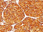 Tyrosinase (Melanoma Marker) Antibody in Immunohistochemistry (Paraffin) (IHC (P))